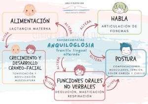 La anquiloglosia (frenillo lingual alterado) tiene una serie de consecuencias que se interrelacionan unas con otras, siendo estas: alteración en la alimentación en el recién nacido (succión) como en niños (deglución) y en la respiración que conllevan a alteraciones en el crecimiento y desarrollo cráneo-facial y postural, que, a su vez, alteran las funciones orales no verbales (masticación, deglución, respiración). Además, la anquiloglosia puede dificultar la correcta articulación de diferentes fonemas.